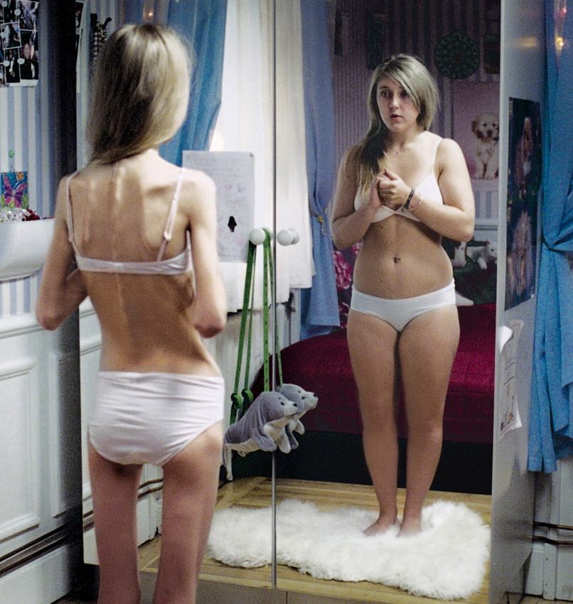 The Mirror – Anorexia,  Direttore Creativo  Martin Stadhammar